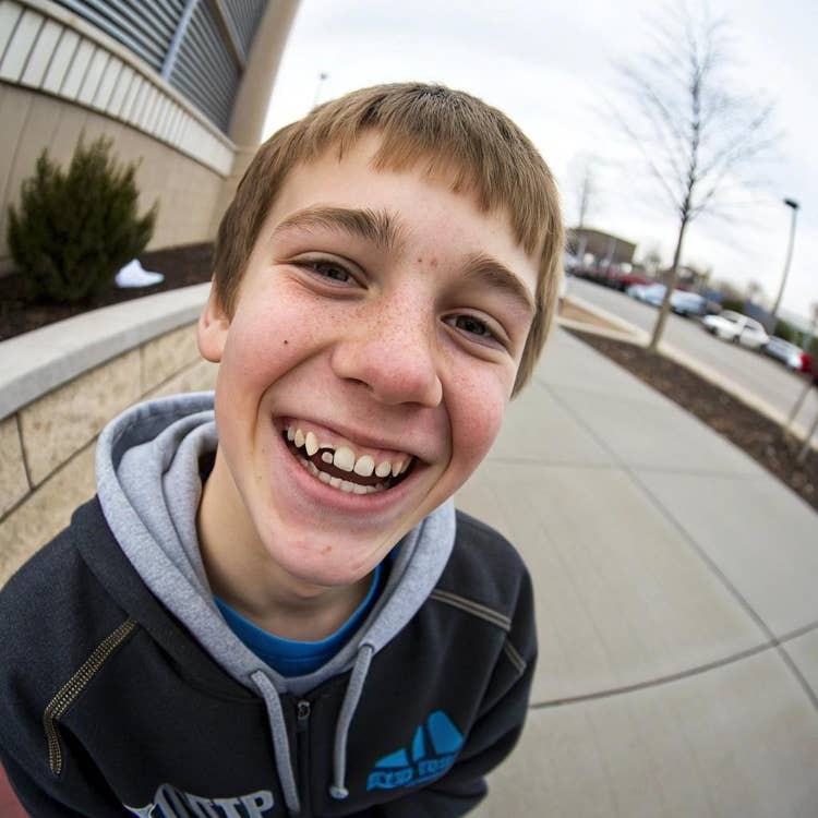 How habit reversal training can help reduce teeth grinding in adolescents with autism