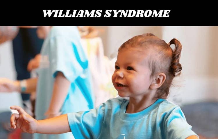 Williams Syndrome